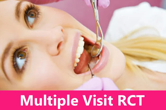 RCT