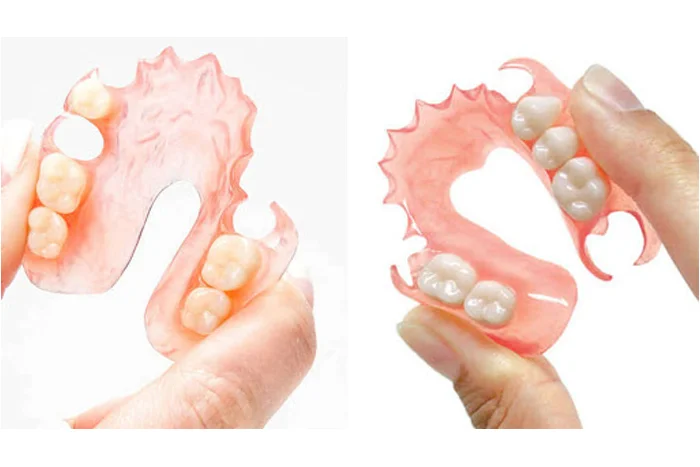 Flexible Denture