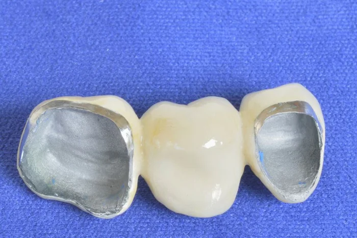 PFM Crown