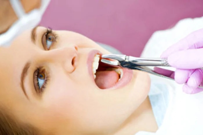 Painless Extraction
